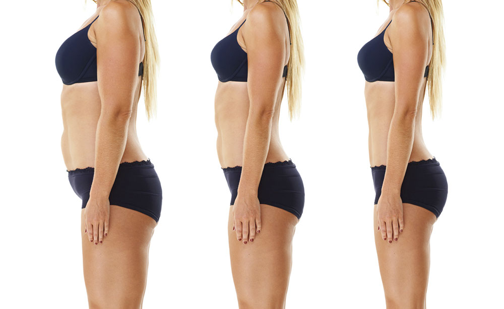 weight loss managementprogression