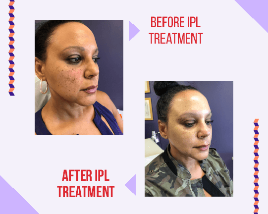 Spring Skin Care