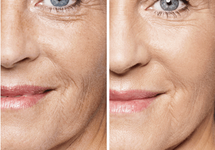 Eros Beauty and Wellness San Diego