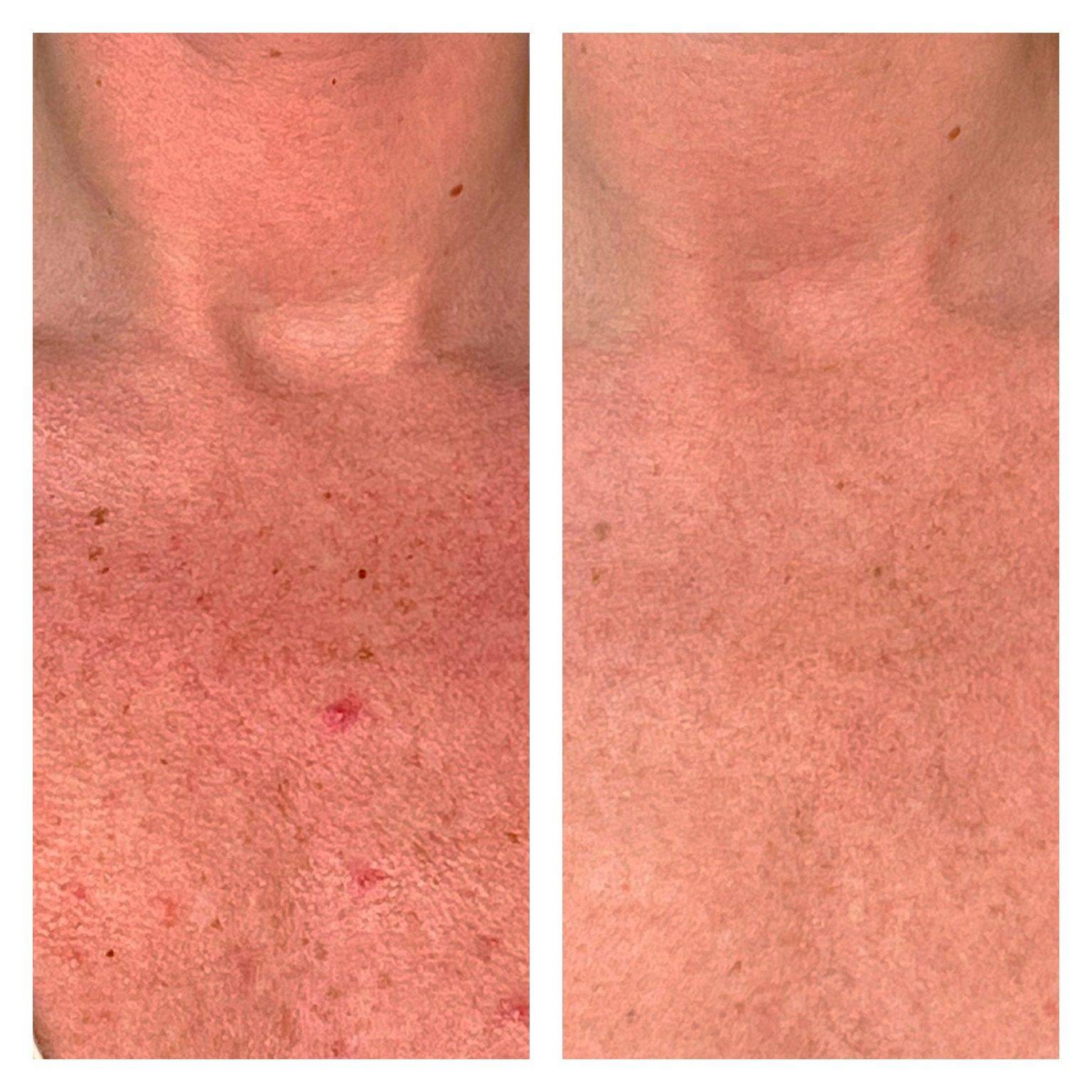 Eros Beauty and Wellness | #1 Medical Spa in San Diego